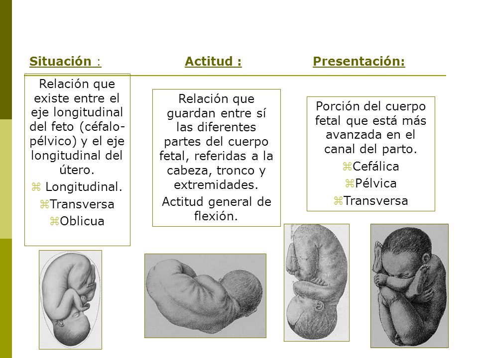 ACTITUD FETAL EPUB ACTITUD FETAL EPUB